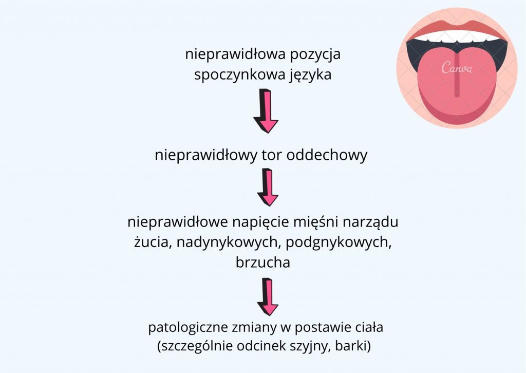Logopeda bada pozycję spoczynkową języka i może wskazać szereg niekorzystnych zmian, jakie niesie za sobą nieprawidłowa pozycja języka w jamie ustnej. 